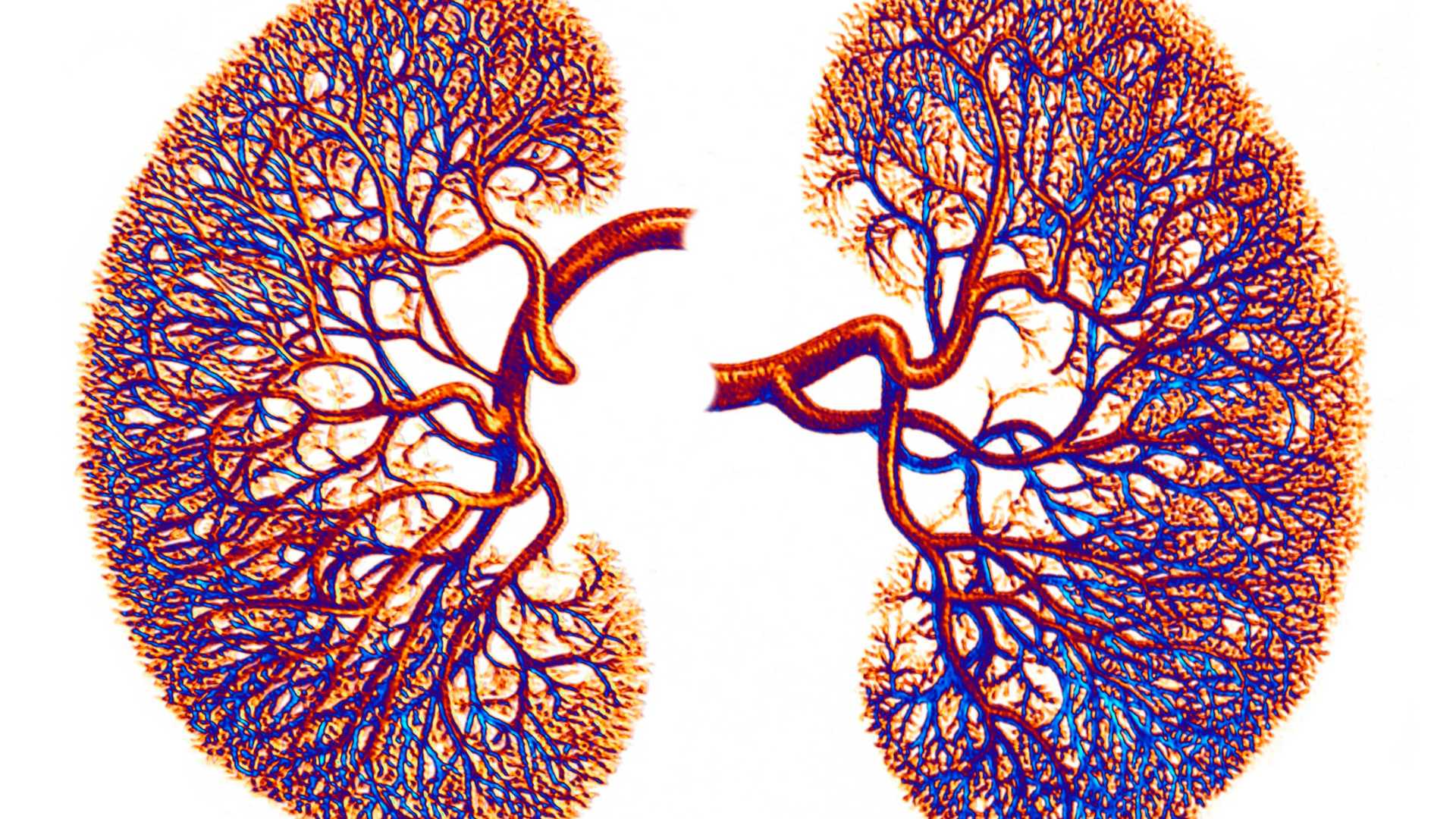 the-severe-consequences-of-alcohol-s-impact-on-the-kidneys